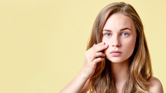 Skin Concern Stigmatization Assessment is validated