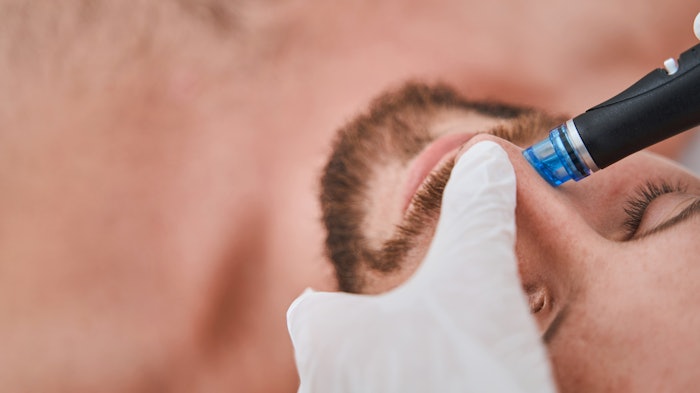 Compelling Study Confirms Hydrafacial Clinically Proven to Clear Acne After 12 Weeks