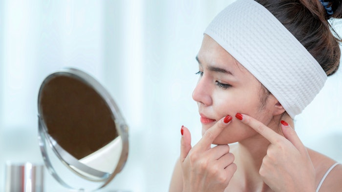 Woman treating her acne