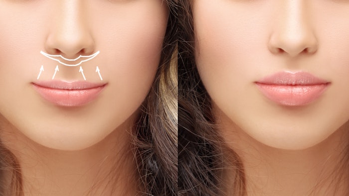 Gen Z Shows Rising Interest in Minimally Invasive Tweakments