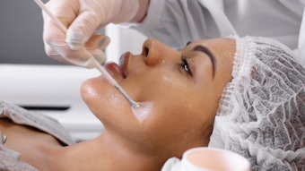 Why PHAs Should Be the Top Pick for First Time Peel Client