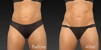 Si2304 Advertorial Ward 850x425 2