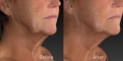 Si2304 Advertorial Ward 850x425 3