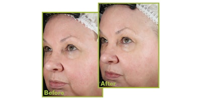 Si2304 Content Marketing Ultraceuticals 850x425 3