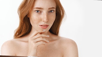 Decoding the Science Behind the Redhead Factor