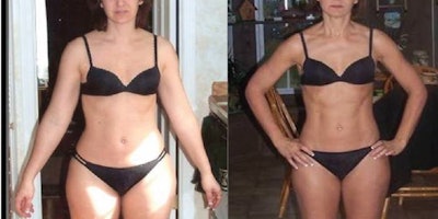 Ward Beforeafter 850x425