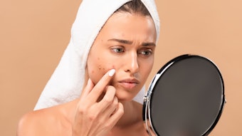 Woman checking her acne in mirror