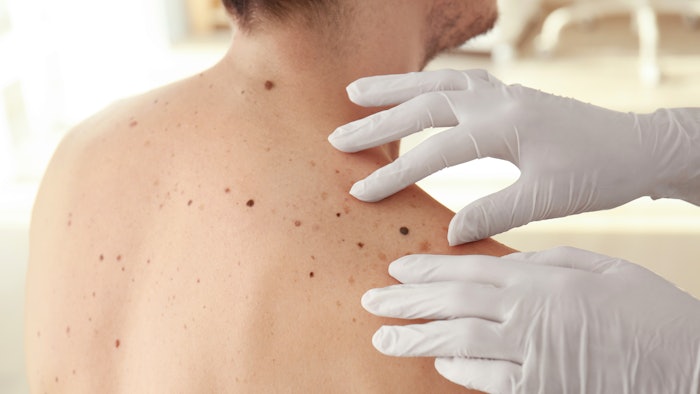 man at dermatologist getting skin exam