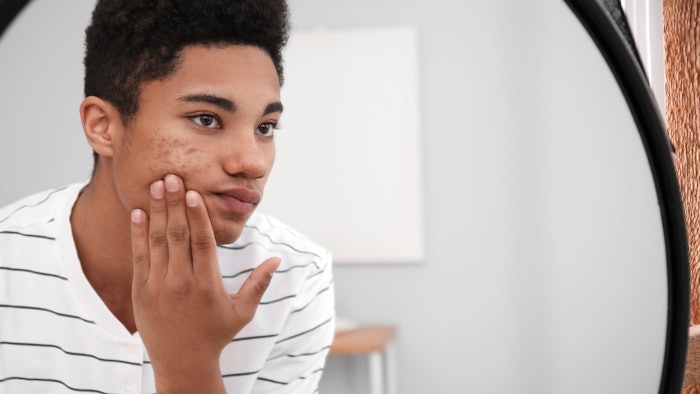 Teenager checking out their skin in the mirror