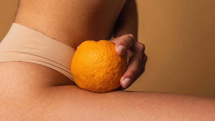 4 Body Slimming Protocols that Target Cellulite