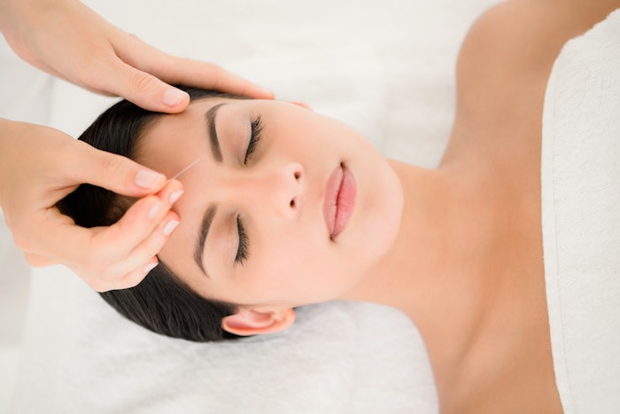 Woman in facial acupuncture therapy