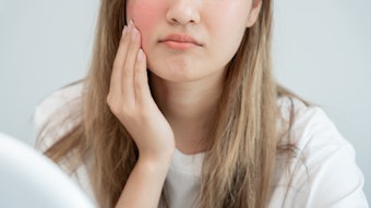 Woman with sensitive skin