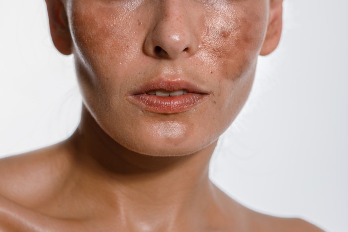 Illuminyl 388 reportedly targets multiple skin pigmentation pathways, paired with prebiotic activity to deliver brightening for skin types from Africa, Asia, India and Europe.