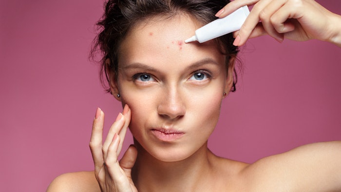 Ask The Esty: Acne Education
