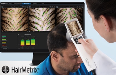 Hair Metrix Additional Element 1000x650