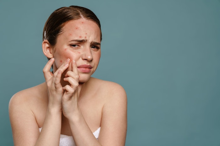 An upcoming exclusive discussion explores how to subdue patients most stubborn acne for good, giving patients long-term relief in the war against acne.