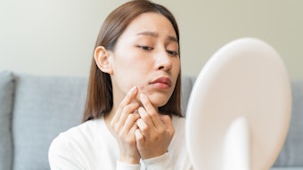Asian young woman worry about acne on her face after wear face mask.