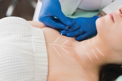 Threads can be used to help tighten and lift the neck and decollete area.