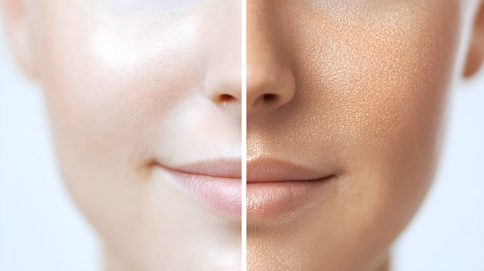 Detailed comparison of skin texture and pigmentation, illustrating Botox's wrinkle reduction and melasma spot fading, clear skin tone in after shot, Soft Lighting, Photorealistic