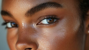 woman with moisture on her skin