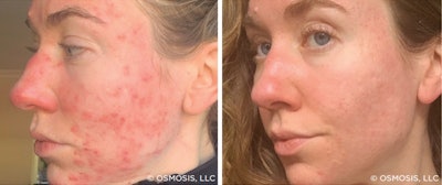 Osmosis Well Spa Nov 2024 Graphic Ba