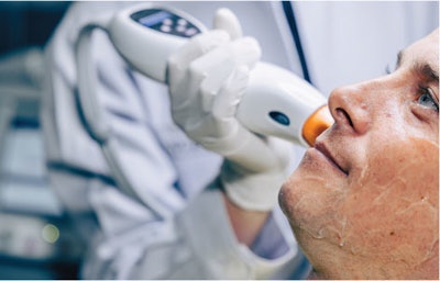 Combine synergistic therapies like laser & topical therapies enhances results.