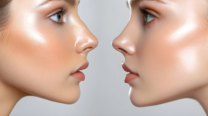 Minimally invasive treatments are attracting individuals who previously avoided medaesthetic procedures due to concerns about pain or downtime.
