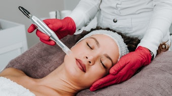 Microneedling in the spa