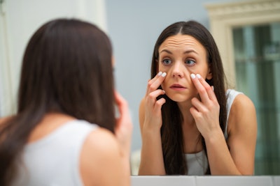 Puffiness, or under-eye bags, are a common aesthetic concern that becomes more prominent with age. This can be caused by fluid retention, decreased skin elasticity or the accumulation of excess fat.