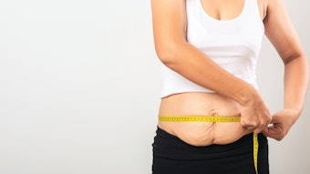 woman measuring her stomach after weight loss
