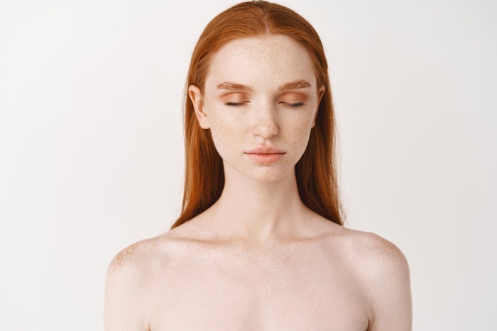 Allergan noticed patients and providers were often using different terminology in describing skin quality, creating a divide in providing effective care. This led to development of the Skin Quality Index.