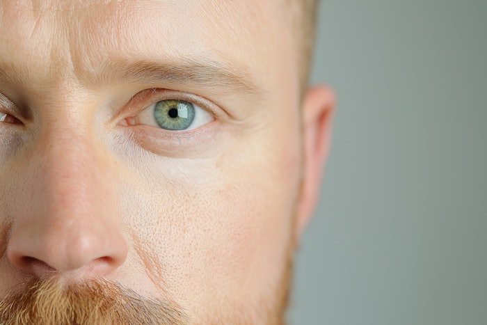 While it may be tempting to use female-centric protocols or 'plug-and-play' treatment paradigms, doing so risks patient dissatisfaction and poor aesthetic results. Male non-surgical procedures such as Botox, dermal fillers and biostimulators require anatomical accuracy and self-control.