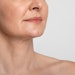 Allergan Aesthetics seeks FDA approval of Skinvive by Juvéderm for the neck.