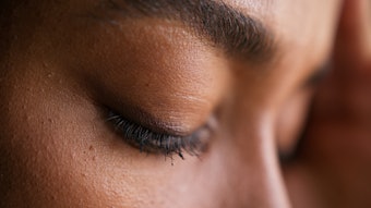 Understanding stressed skin patterns can allow you to treat clients in a more personalized manner.