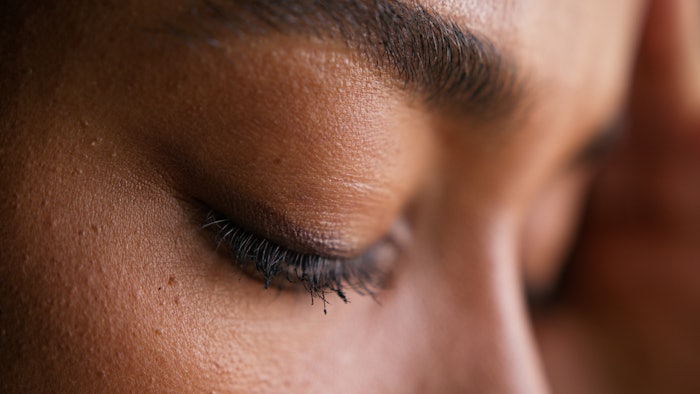 Understanding stressed skin patterns can allow you to treat clients in a more personalized manner.