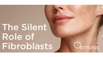 Osmosis Fibroblasts 800x450px