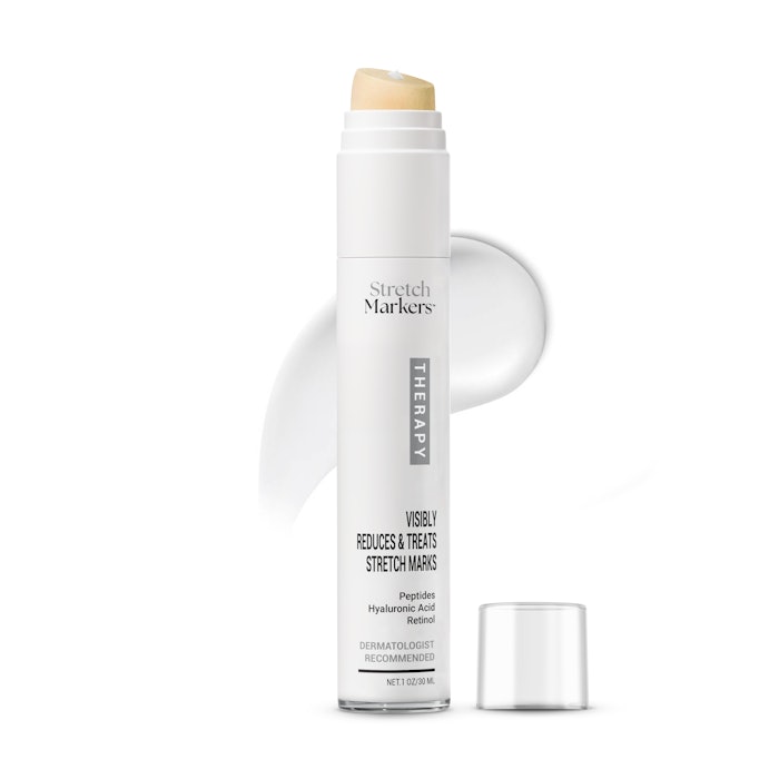 Stretch Marks are becoming more prevalent and consumers are looking for the latest in minimally invasive procedures, synergistic treatments and advanced topicals to treat them.