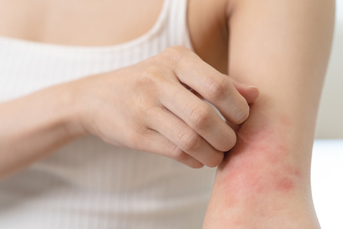 Having so many people afflicted by sensitive skin means a growing demand for gentle, more specialized products.