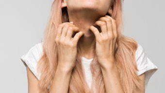 Environmental stressors like pollution and UV radiation are just a couple of examples of what can exacerbate inflammation.