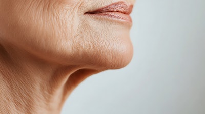 Senescent cells release inflammatory signals that degrade collagen and disrupt regeneration, while aging stem cells lose their ability to renew the skin.