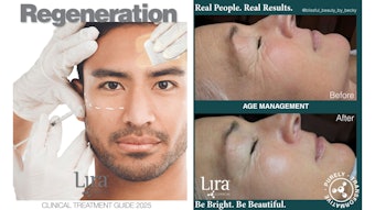 Lira Clinical has been long respected for its use of advanced technology and ingredients.