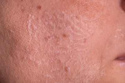 Growing consumer awareness means that skin is no longer a one-size-fits-all; now they're looking into their specific skin needs.