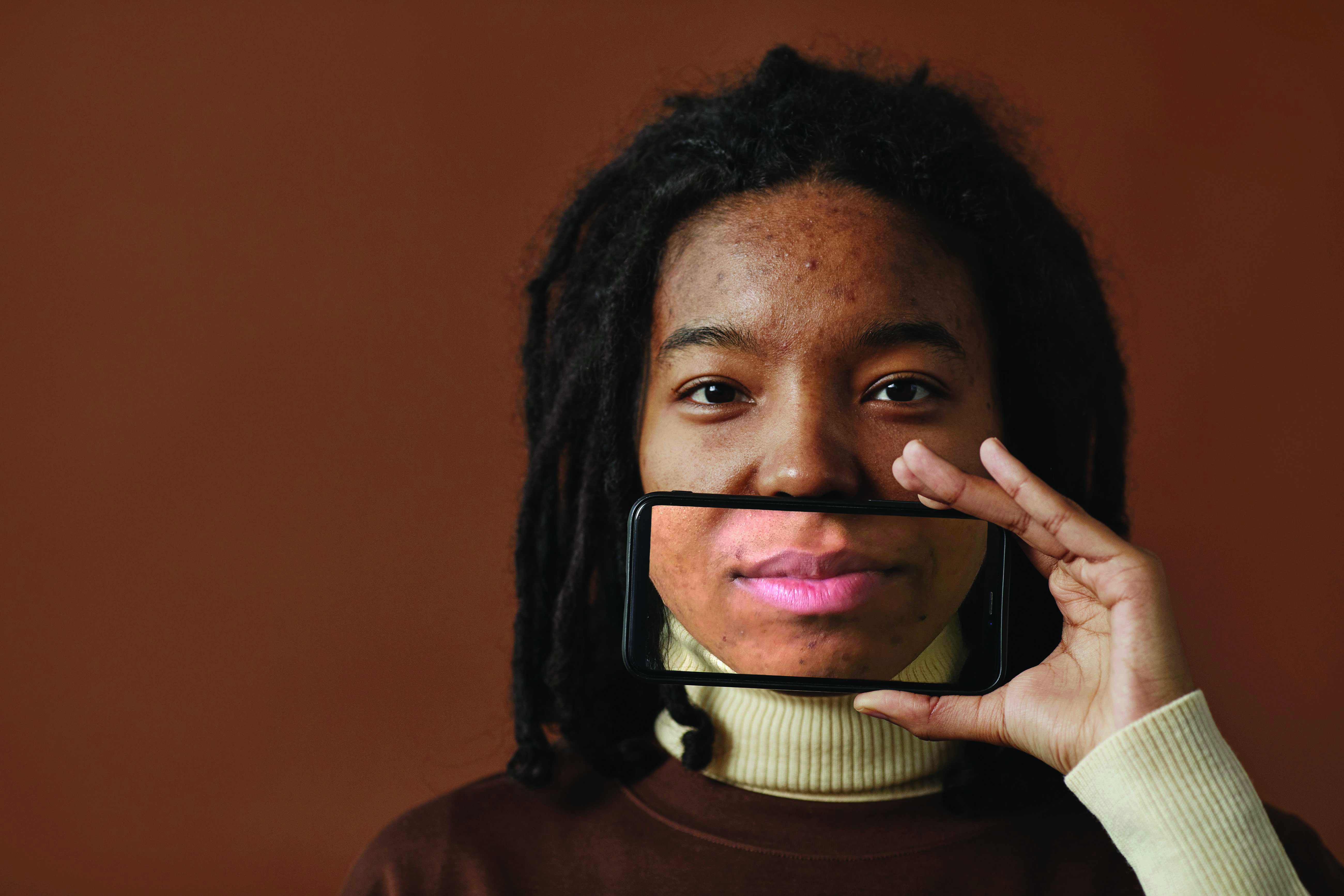 Clients looking to manage acne and pursue a healthier lifestyle? You may be able to kill two birds with one stone.