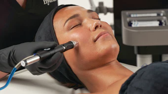 Hydrafacial Rosalie Model Lisa Treatmt 01