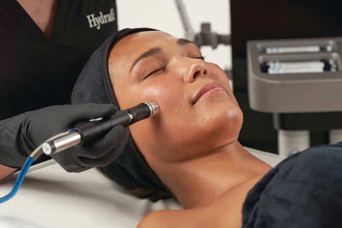 Hydrafacial Rosalie Model Lisa Treatmt 01