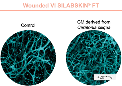 Figure 2 - Effect of GM derived from Ceratonia siliqua on the vascularization observed on wounded VI SILABSKIN FT.