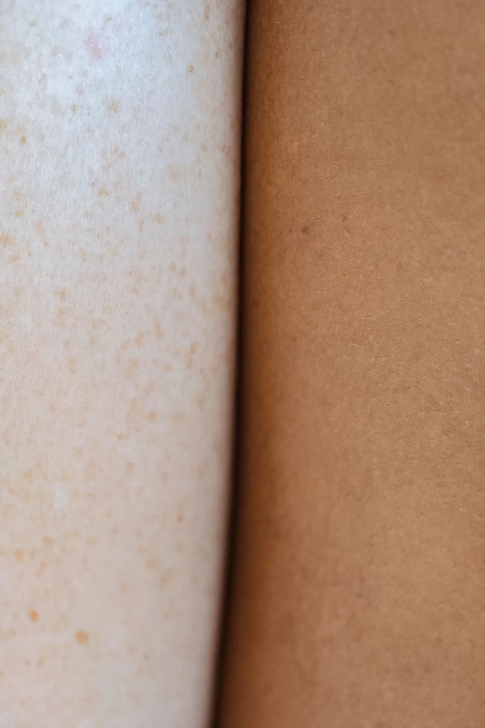 Close-up comparison of two different skin tones side by side showing diversity