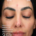 Before and after results from using PCA Skin's Acne Prebiotic Gel Cleanser.