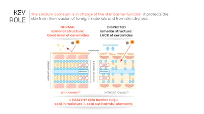 Diagram comparing normal and disrupted skin barrier structure, showing ceramide levels and moisture retention with and without Cerave products
