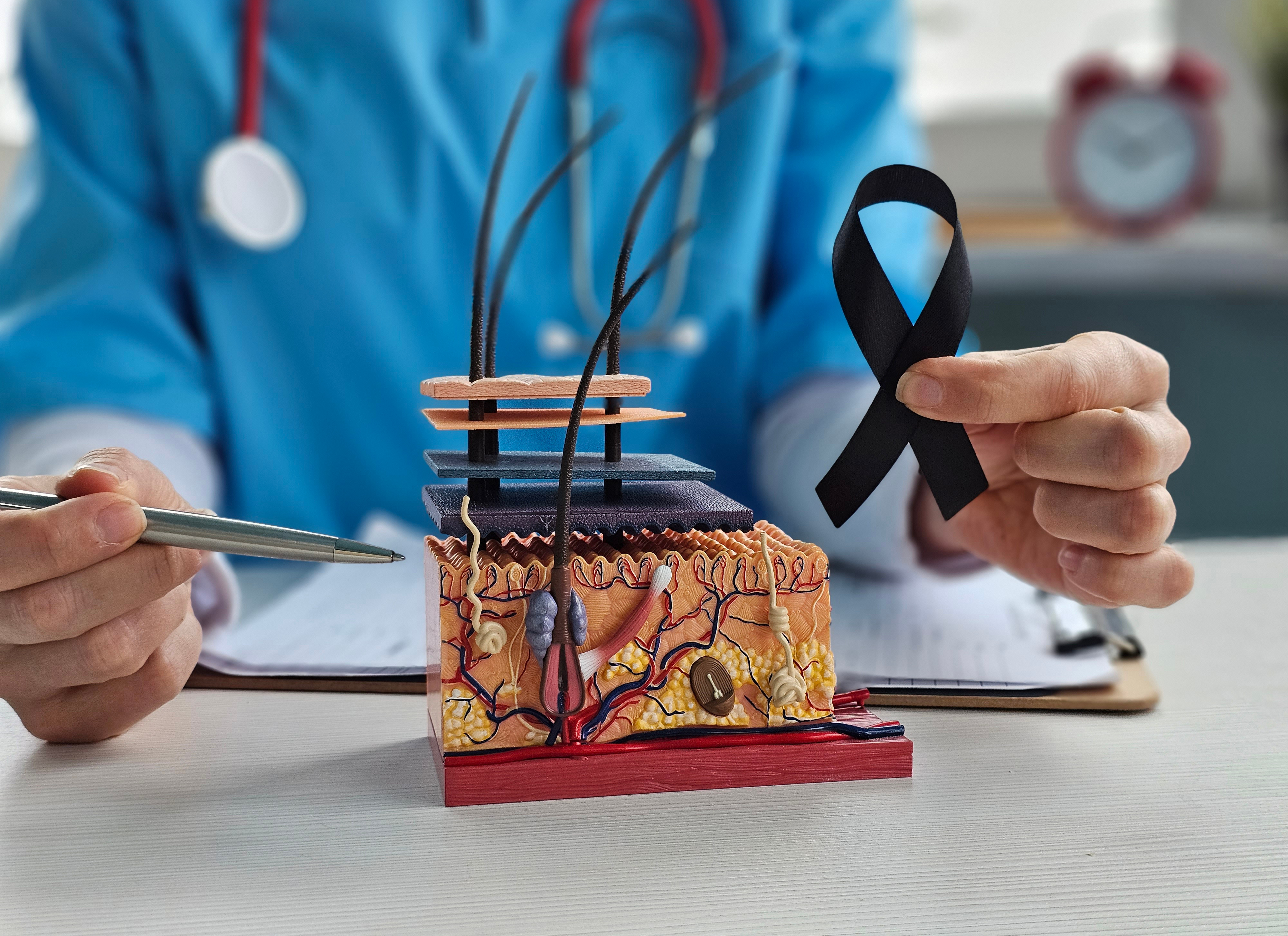 Healthcare professional holding black awareness ribbon beside anatomical skin tissue model in clinical setting